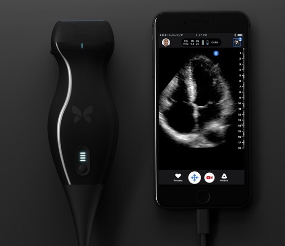  Portable ultrasound